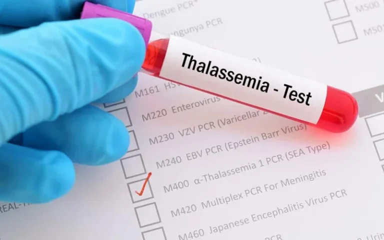 talasemia-الثلاسيميا
