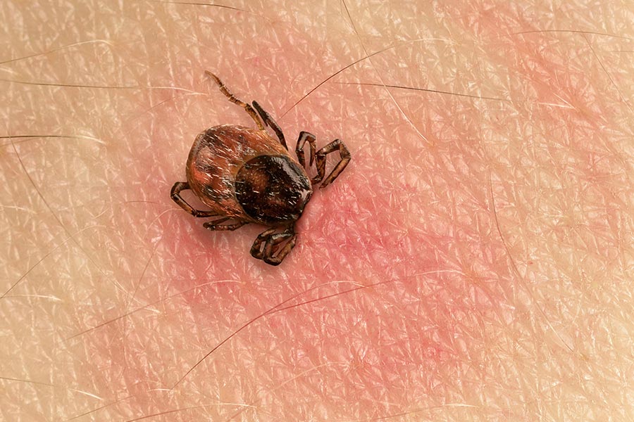lyme-disease-مرض-لايم