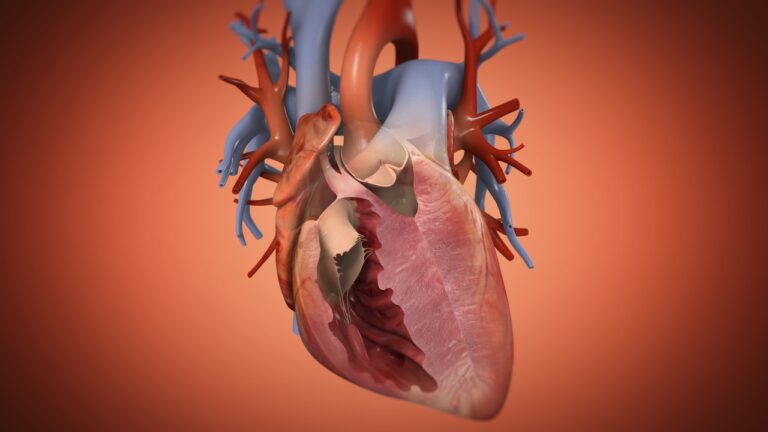 مرض hlhs