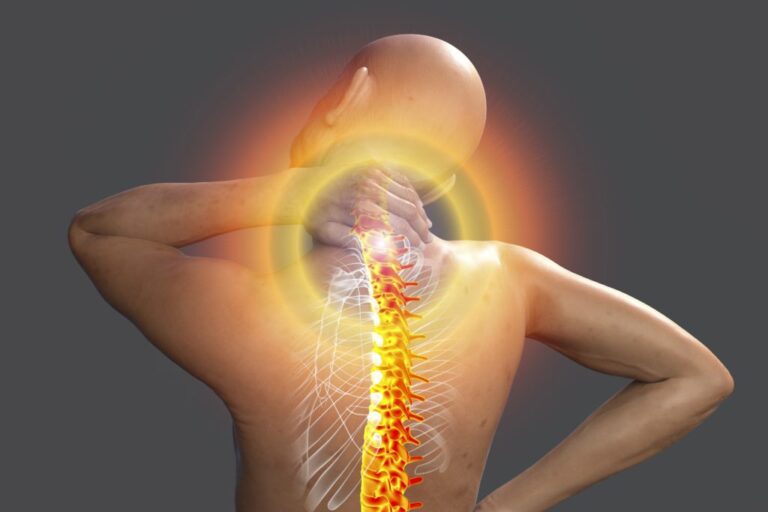 مرض الفيبروميالجيا (Fibromyalgia) - الألم العضلي الليفي